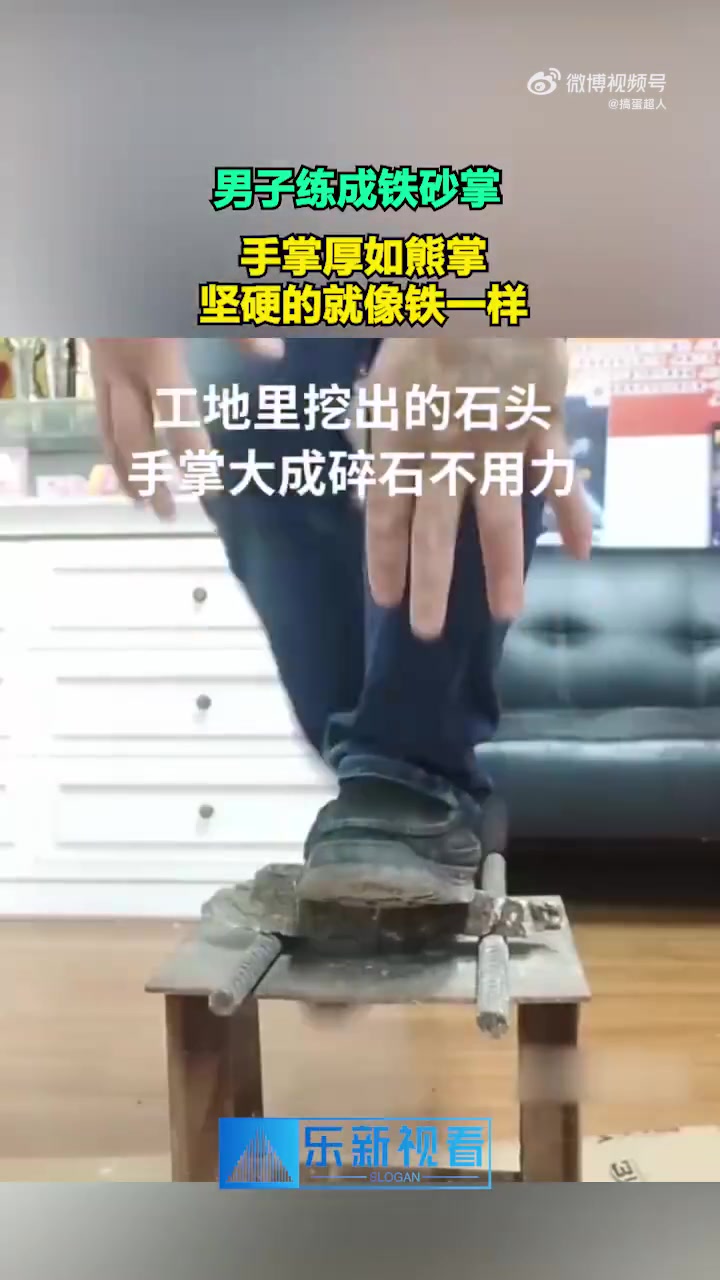 男子练成铁砂掌 手掌厚如熊掌